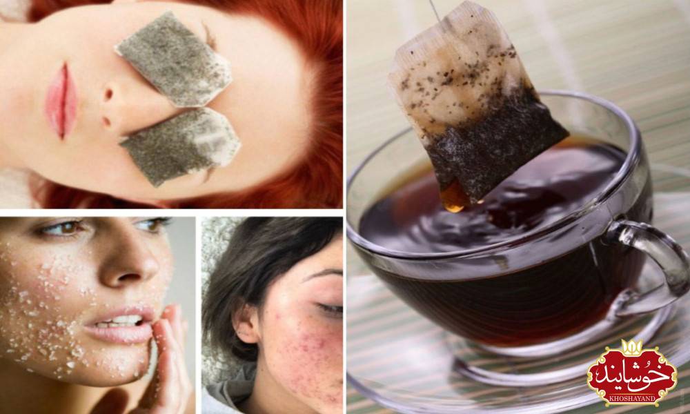 تیره شدن پوست بخاطر چای؟